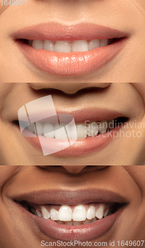 Image of Close up female lips. Vertical collage. Nude makeup. Cosmetology, skin care concept. Flyer for ad.