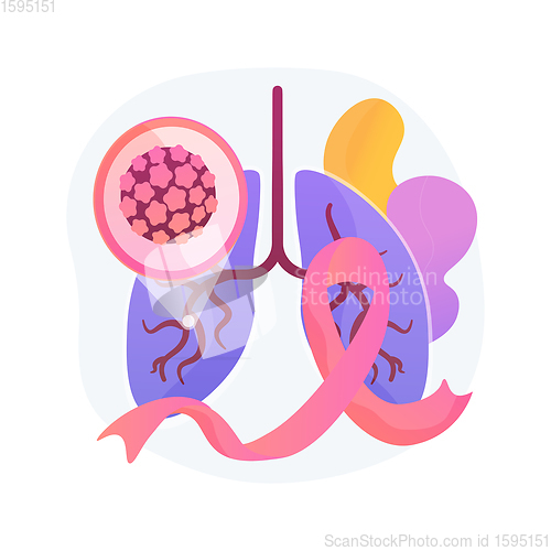 Image of Lung cancer abstract concept vector illustration.