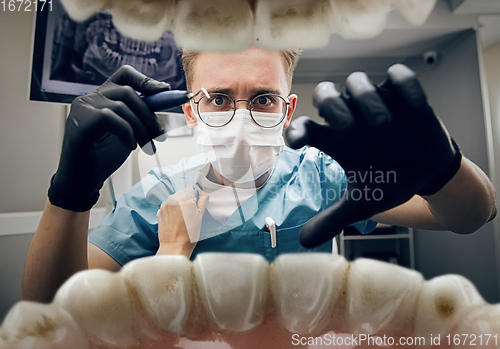 Image of Doctor looking into the mouth, checking, examining teeth