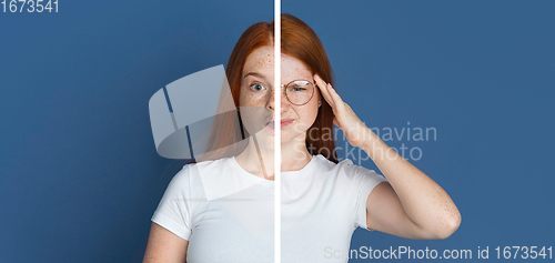 Image of Fun and creative combination of portraits of young girl with different emotions, various facial expression on splited studio background.