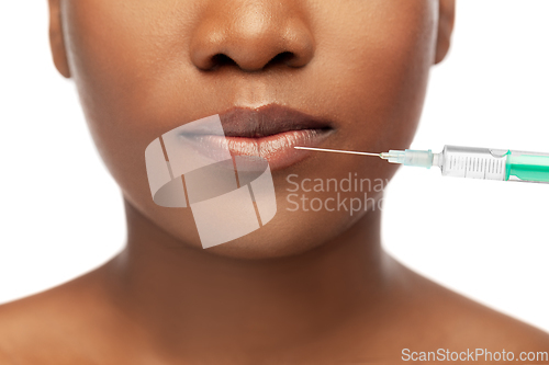 Image of lips of african american woman and syringe