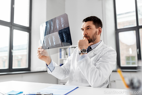 Image of male doctor with x-ray of spine at hospital