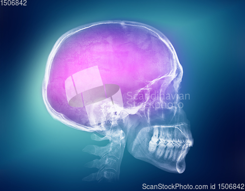 Image of Human skull X-ray image