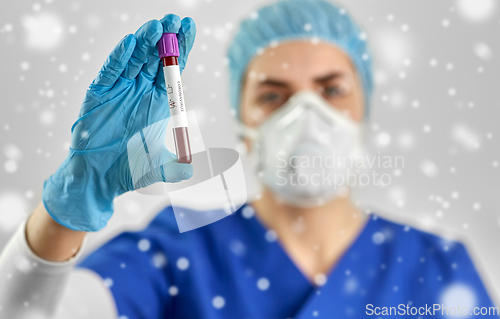 Image of doctor holding beaker with coronavirus blood test