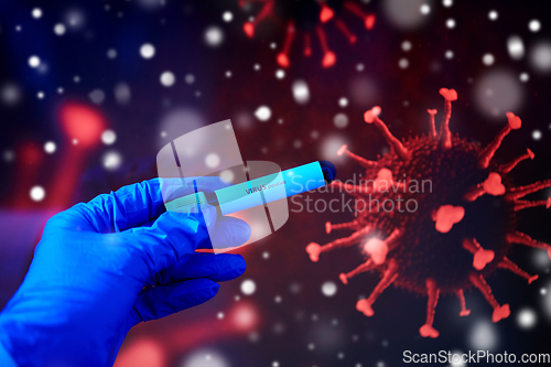 Image of hand holding beaker with coronavirus blood test