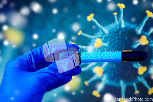 Image of hand holding beaker with coronavirus blood test