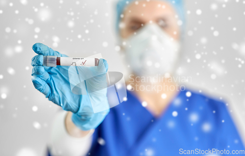 Image of doctor holding beaker with coronavirus blood test