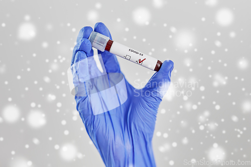 Image of hand holding beaker with coronavirus blood test