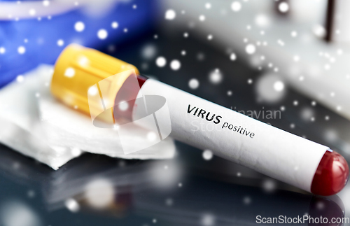 Image of beaker with virus blood test at laboratory