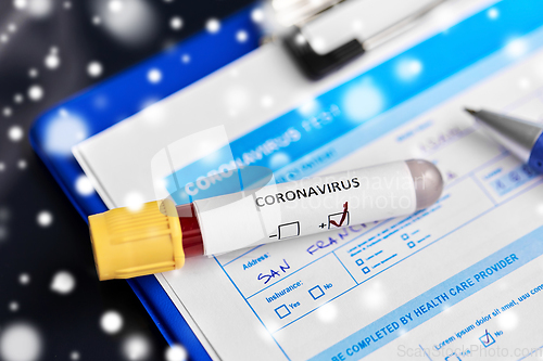 Image of close up of beaker with coronavirus blood test