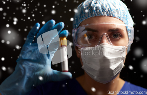 Image of close up of doctor holding beaker with blood test