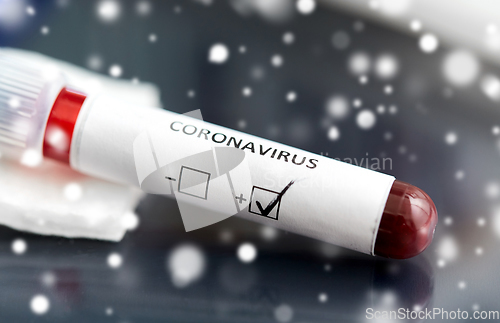 Image of beaker with coronavirus blood test at laboratory