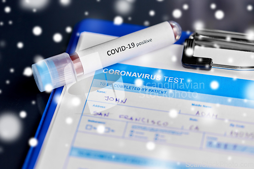 Image of close up of beaker with coronavirus blood test