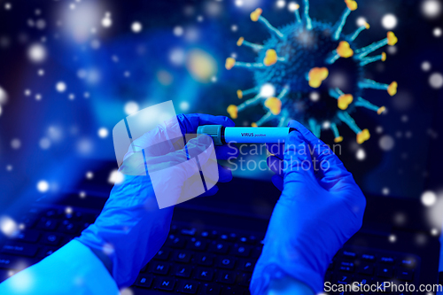 Image of hand holding beaker with coronavirus blood test