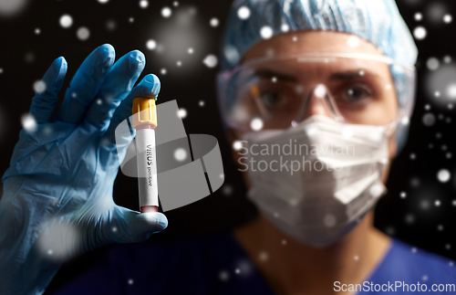 Image of doctor holding beaker with virus blood test