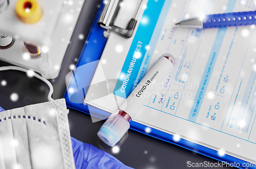 Image of beaker with coronavirus blood test at hospital