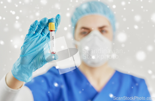 Image of doctor holding beaker with virus blood test