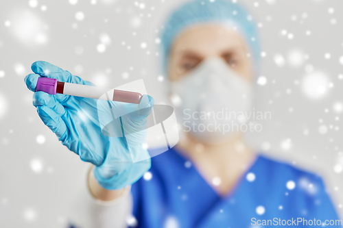 Image of close up of doctor holding beaker with blood test