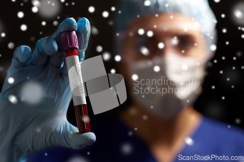 Image of doctor holding beaker with coronavirus blood test