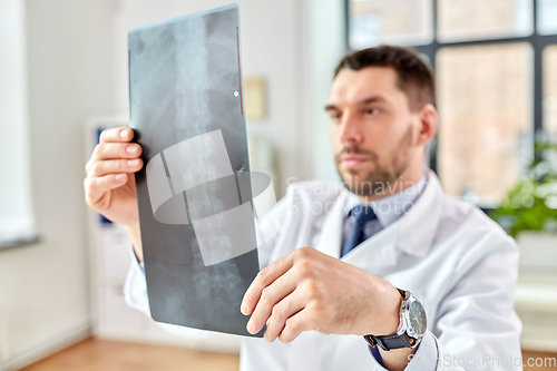 Image of male doctor with x-ray of spine at hospital