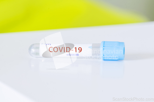 Image of Covid-19 test tube for the Corona virus