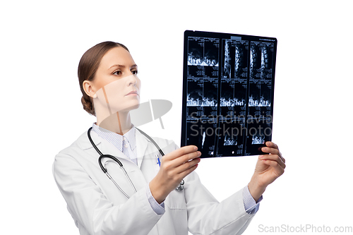 Image of female doctor with x-ray