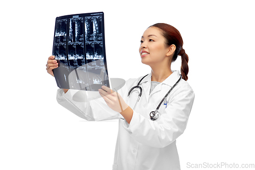 Image of happy smiling asian female doctor looking at x-ray