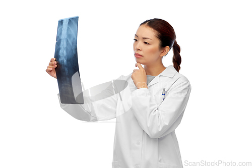 Image of asian female doctor looking at x-ray of spine