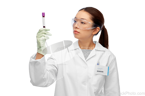 Image of asian female doctor holding beaker with blood test