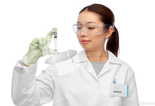 Image of asian female doctor holding beaker with blood test