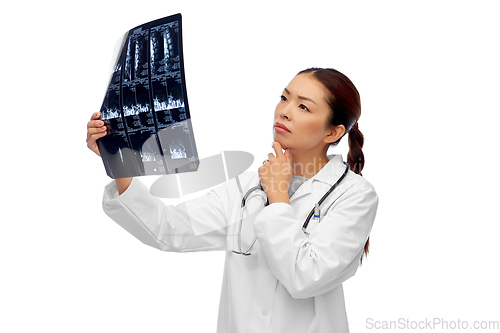 Image of asian female doctor looking at x-ray scan