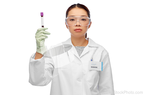 Image of asian female doctor holding beaker with blood test