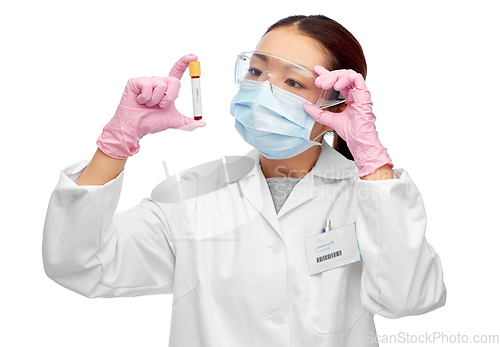 Image of asian female doctor holding beaker with blood test