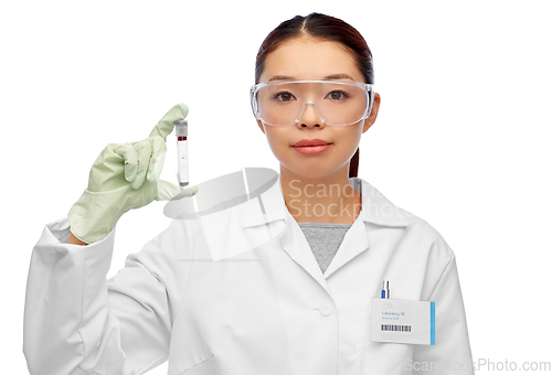 Image of asian female doctor holding beaker with blood test