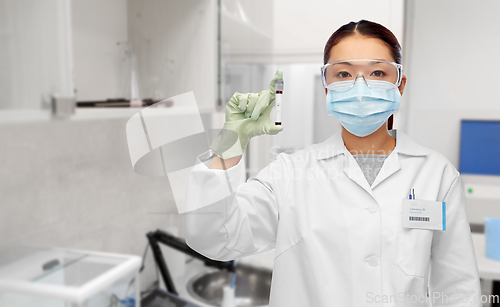 Image of asian female doctor holding beaker with blood test