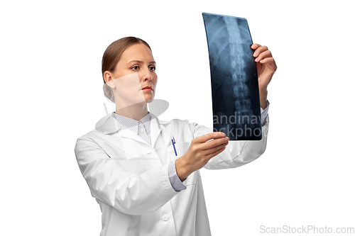 Image of female doctor with x-ray of spine