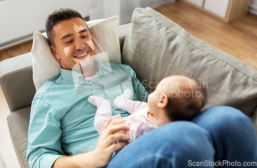 Image of middle aged father having vitiligo with baby