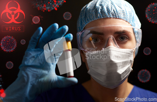 Image of close up of doctor holding beaker with blood test