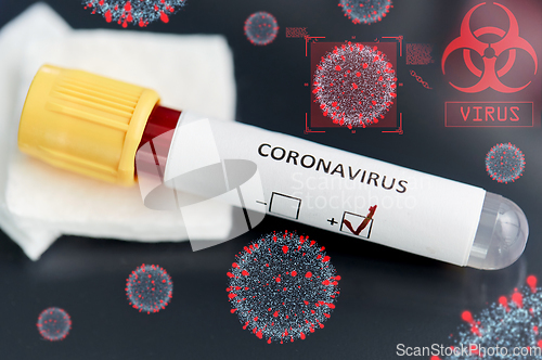 Image of beaker with coronavirus blood test