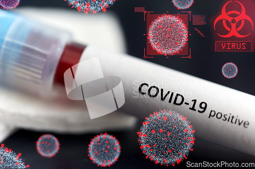 Image of beaker with coronavirus blood test over virions