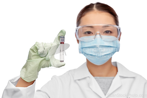 Image of asian female doctor holding beaker with blood test