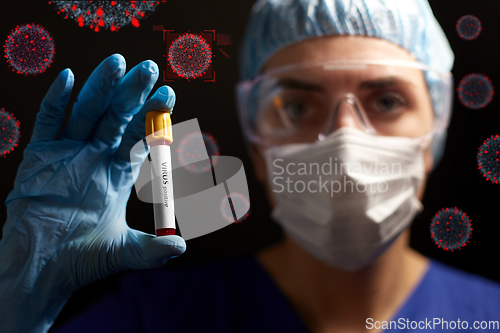 Image of doctor holding beaker with virus blood test