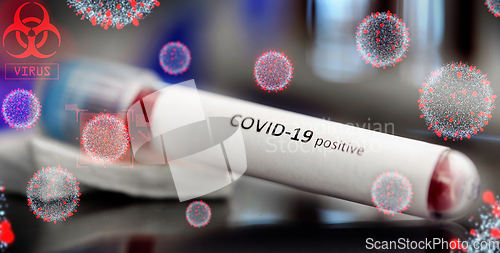 Image of beaker with coronavirus blood test at laboratory