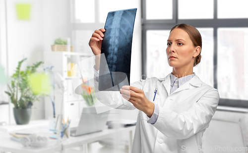 Image of female doctor with x-ray of spine at hospital