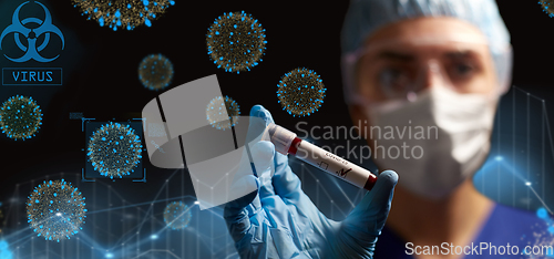 Image of doctor holding beaker with coronavirus blood test