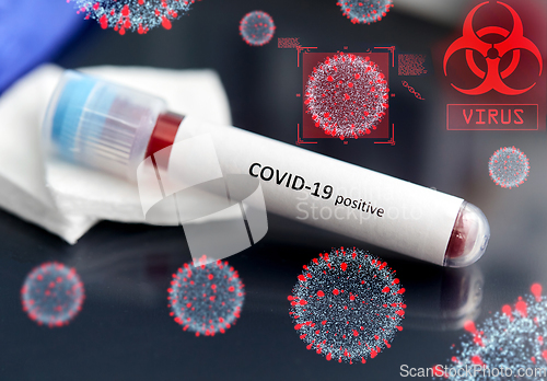 Image of beaker with coronavirus blood test over virions