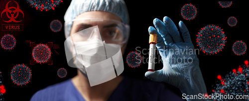 Image of doctor holding beaker with virus blood test