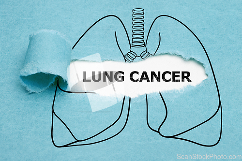 Image of Lung Cancer Drawn Concept