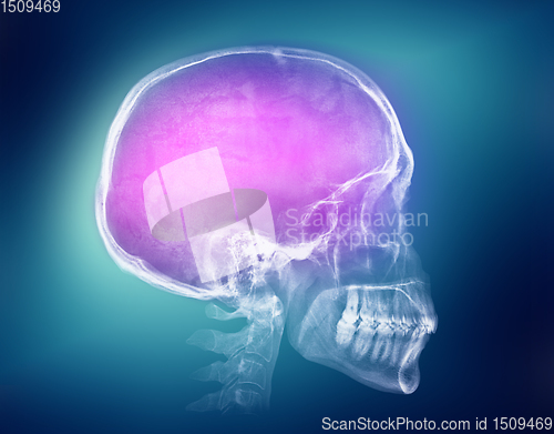 Image of Human skull X-ray image