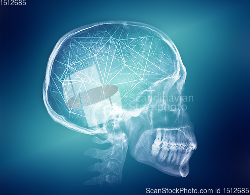 Image of Human skull X-ray image. Artificial intelligence concept